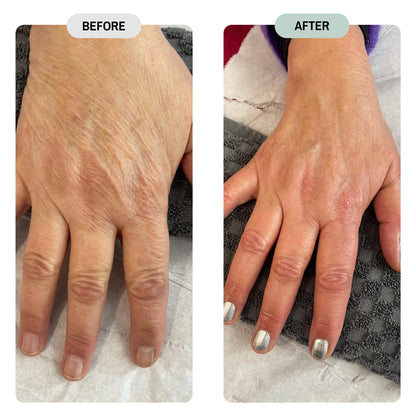 Whole Tree Crepey Skin Repair Treatment