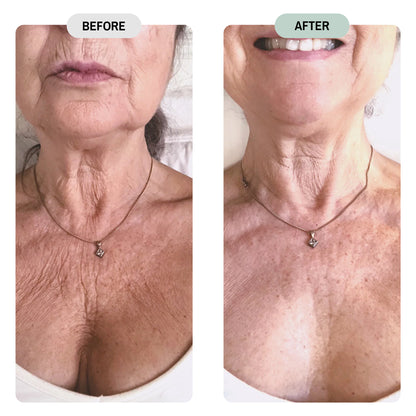 Whole Tree Crepey Skin Repair Treatment