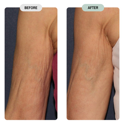 Whole Tree Crepey Skin Repair Treatment